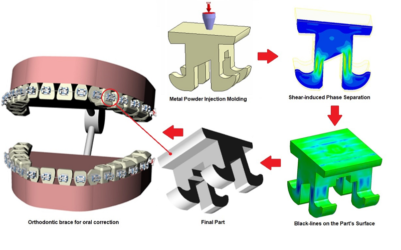 Metal Injection Molding Bracket